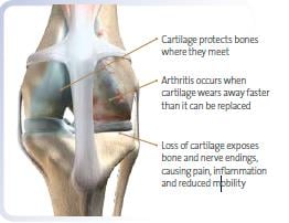 Arthritis in dogs